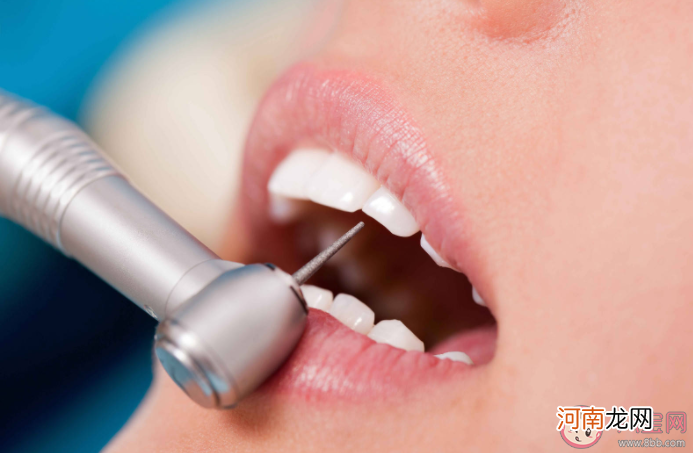 洗牙|洗牙是怎么把牙缝冲大的 洗牙能把牙齿洗出裂纹吗