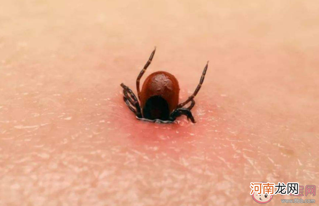 蜱虫|在身上发现了蜱虫该怎么处理 蜱虫叮咬预防建议