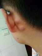 耳后淋巴癌早期症状图片 耳朵里面长了个硬包