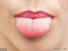舌苔厚黄是什么原因 舌苔发黄又厚是怎么回事