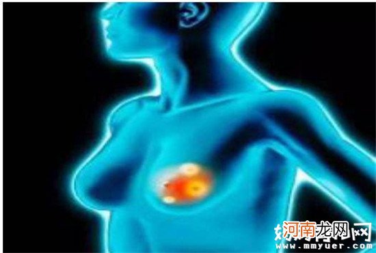 乳腺增生可以按摩缓解吗 简单易学的三种按摩手法