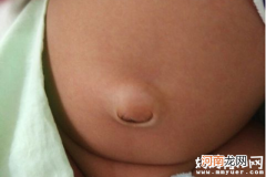 宝宝脐疝重者危害生命 两个月宝宝有脐疝怎么办