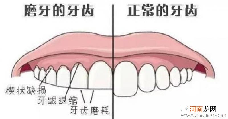 磨牙吃什么