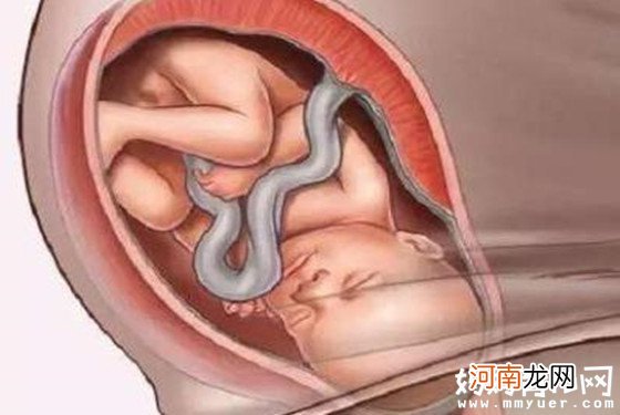 胎儿入盆是啥时候 胎儿入盆后多久会生
