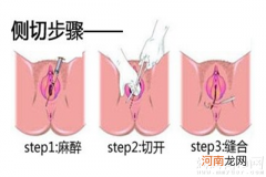 顺产一定要侧切吗?顺产不想侧切怎么办？