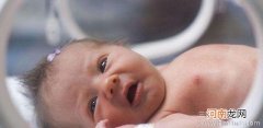 早产儿怎么算月龄1分钟学会两种计算方法来搞定