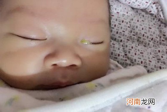 婴儿起眼屎是什么原因 新生儿有眼屎怎么处理