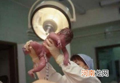 一位顺产妈妈分娩全过程图片
