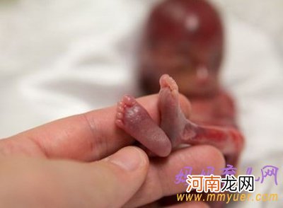 图片 美国妈妈产下19周早产儿 看着就揪心