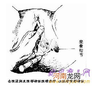 图片 顺产侧切伤口护理方法及注意事项