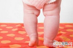 以为宝宝是罗圈腿？来看看新生儿小腿弯曲正常吗