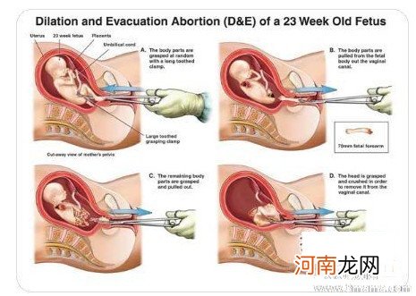 生产时不给医生说人流史可以吗 医生会对这件事情保密吗