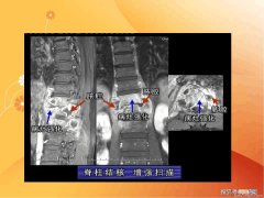 1分钟科普：一侧股骨长是什么意思、股骨长标准值怎么看