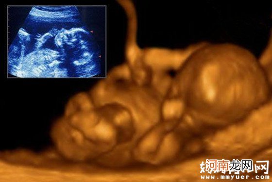 怀孕六个月胎儿图什么样 四张图让你读懂它