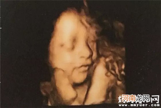 六个月的胎儿图什么样 五张胎儿图来解读