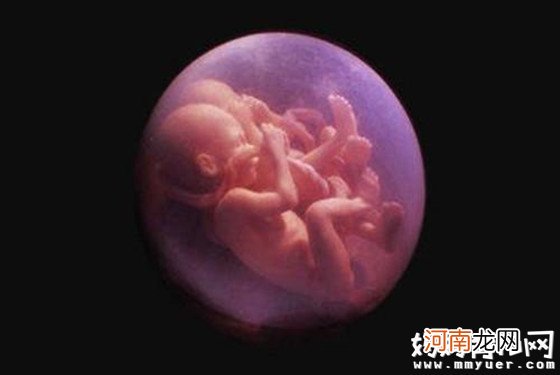 怀孕三个月胎儿到底有多大 一张彩超图让你秒懂