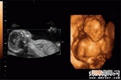 怀孕八个月胎儿彩超图 吃手指、打哈欠模样萌翻