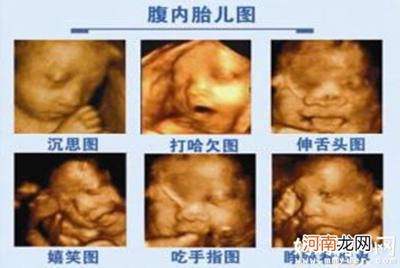 怀孕八个月胎儿彩超图 吃手指、打哈欠模样萌翻