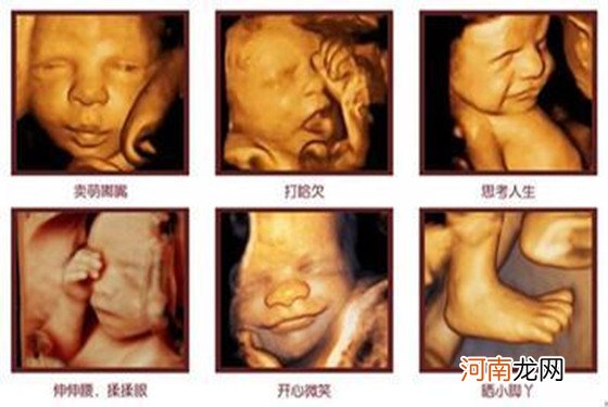 怀孕6个月四维彩超图 一清二楚的看到胎儿在打哈欠