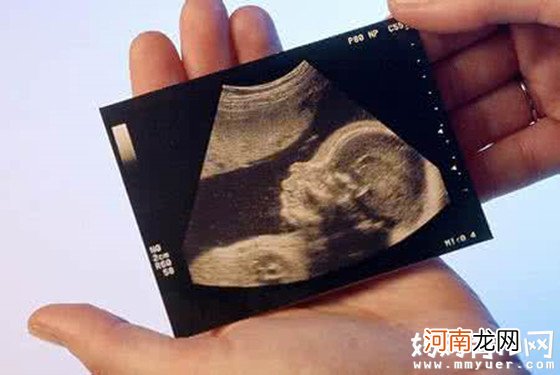 【怀孕32周】32周胎儿多大 孕32周胎儿发育指标标准