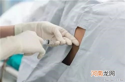 剖腹产麻醉后会睡着吗盘点剖腹产不为人知的的5种痛