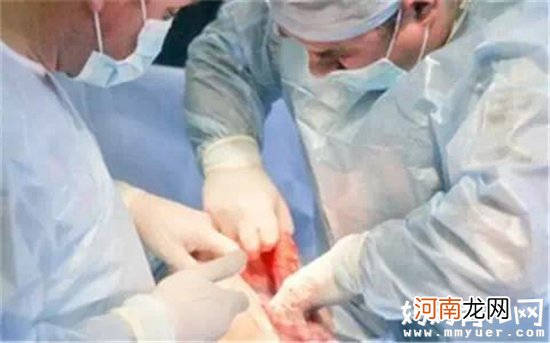 场面温馨又血腥 孕妈剖腹产生宝宝的全过程曝光