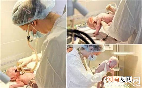 场面温馨又血腥 孕妈剖腹产生宝宝的全过程曝光