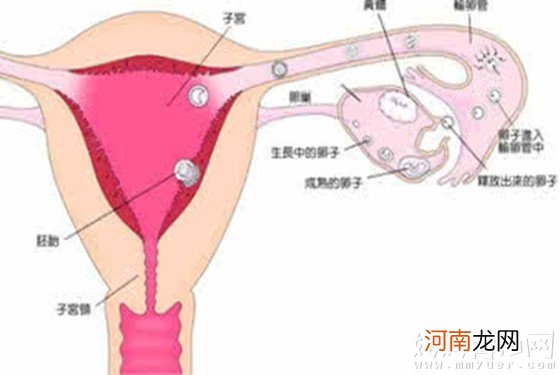 宫外孕有哪些症状表现 常见宫外孕的治疗方法是什么