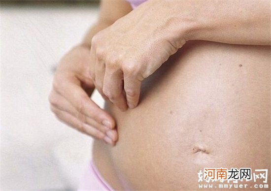 孕期皮肤瘙痒要注意 这些孕期皮肤变化会引起严重后果