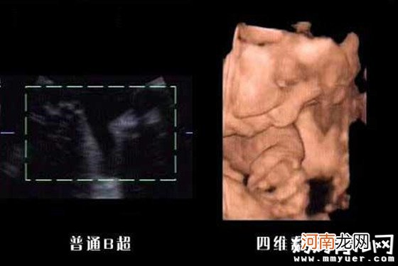 怀孕八个月男胎儿图怎么看 如此辨认男女so easy！