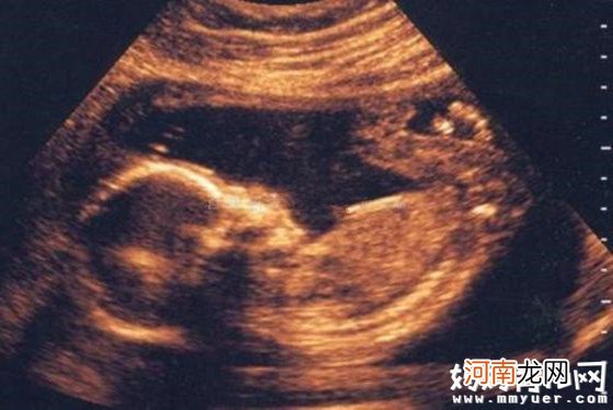 怀孕八个月男胎儿图怎么看 如此辨认男女so easy！