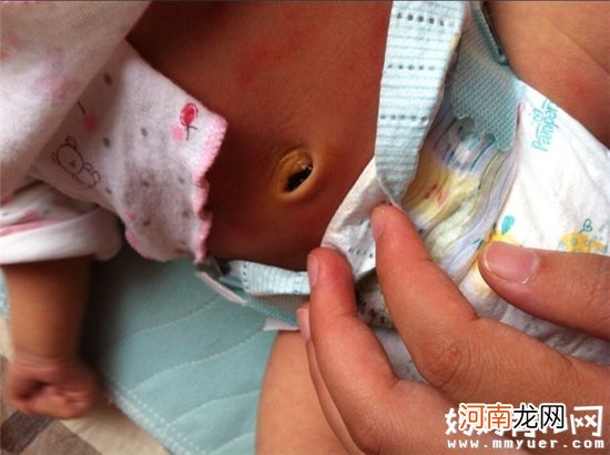 助产士决定宝宝肚脐是否漂亮 宝宝剪脐带的最佳时间