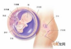 胎儿宫内发育迟缓治疗方案以及新生儿护理
