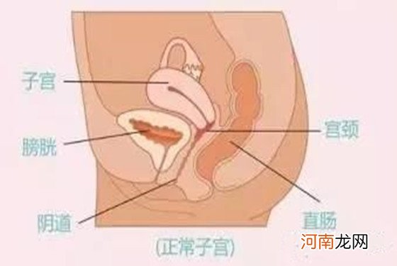 关于子宫前位容易怀男孩吗的问题 网友们这样说