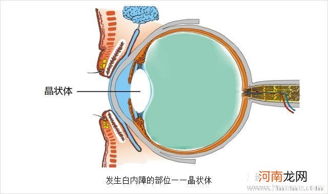 白内障手术价格