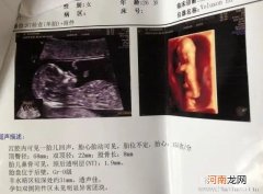 解析孕妇为什么大腿内侧疼原因只有这一个