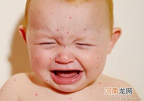 引起宝宝湿疹的四大因素