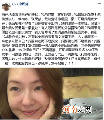 小s频频爆出自己整形，难道不需要恢复期的嘛？