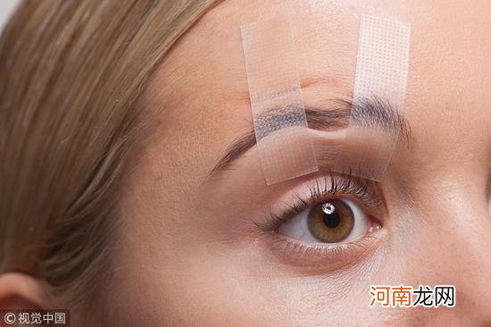 做双眼皮手术前，需要做哪些准备？