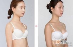 产后胸部下垂 母乳喂养是凶手？