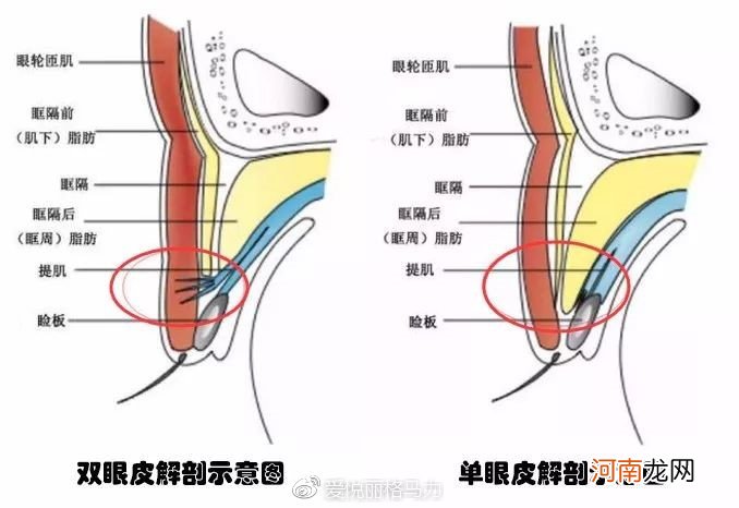 长期贴双眼皮贴能形成真正的双眼皮吗?