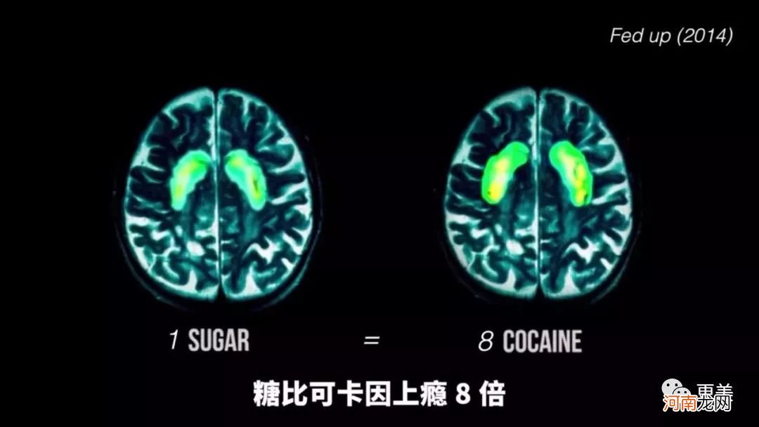 爆痘、衰老、痴呆，新一代年轻人正在被奶茶毁掉