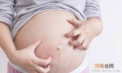 胎动引起孕妇肚脐眼疼