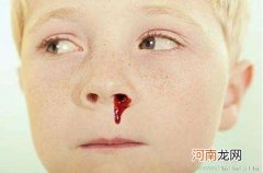 儿童鼻出血处理