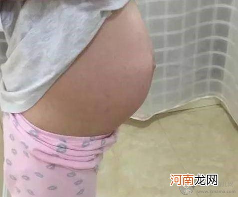 什么提示你怀了男宝宝：判断生男生女的小妙招