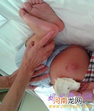 太过分了！孩子不听话 幼儿园老师用针头扎屁股