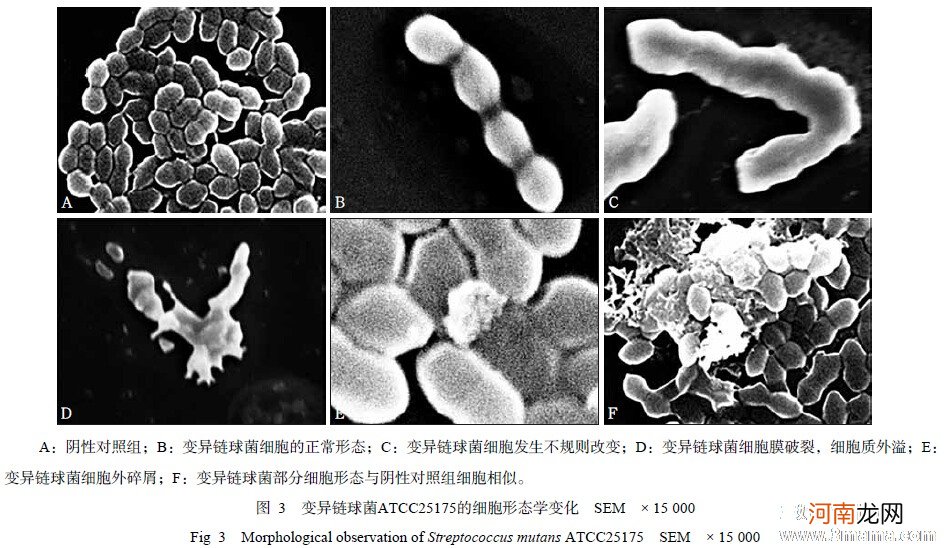 o型rh阴性血二胎溶血率