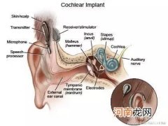 听力毛发细胞培育或治失聪