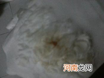 哺乳期来褐色分泌物是月经吗