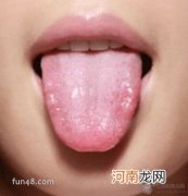 舌尖痛是怎么回事